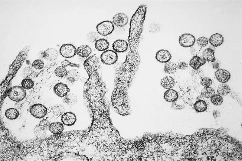 Microscopic view of viral particles