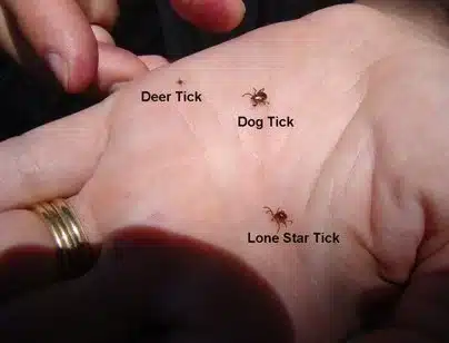 Ticks identified on a hand