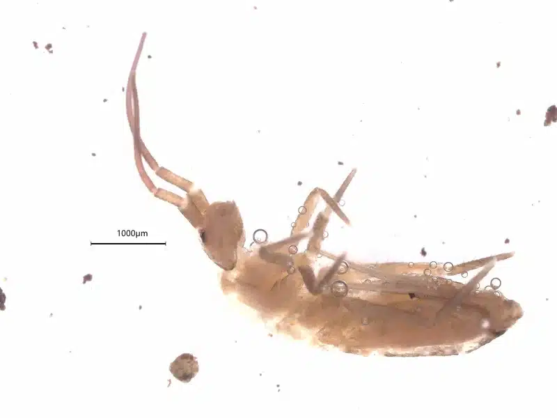Microscopic view of springtail showing segmented body